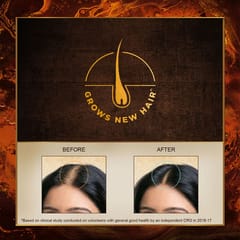 Indulekha Hair Oil Bringraj - 100Ml