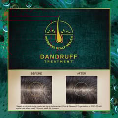 Indulekha Svetakutaja Oil Ayurvedic Medicinal Oil For Dandruff Treatment 100% Ayurvedic Oil