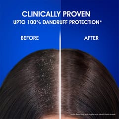 Head & Shoulders , Anti Dandruff Shampoo, Smooth & Silky, 340 ML